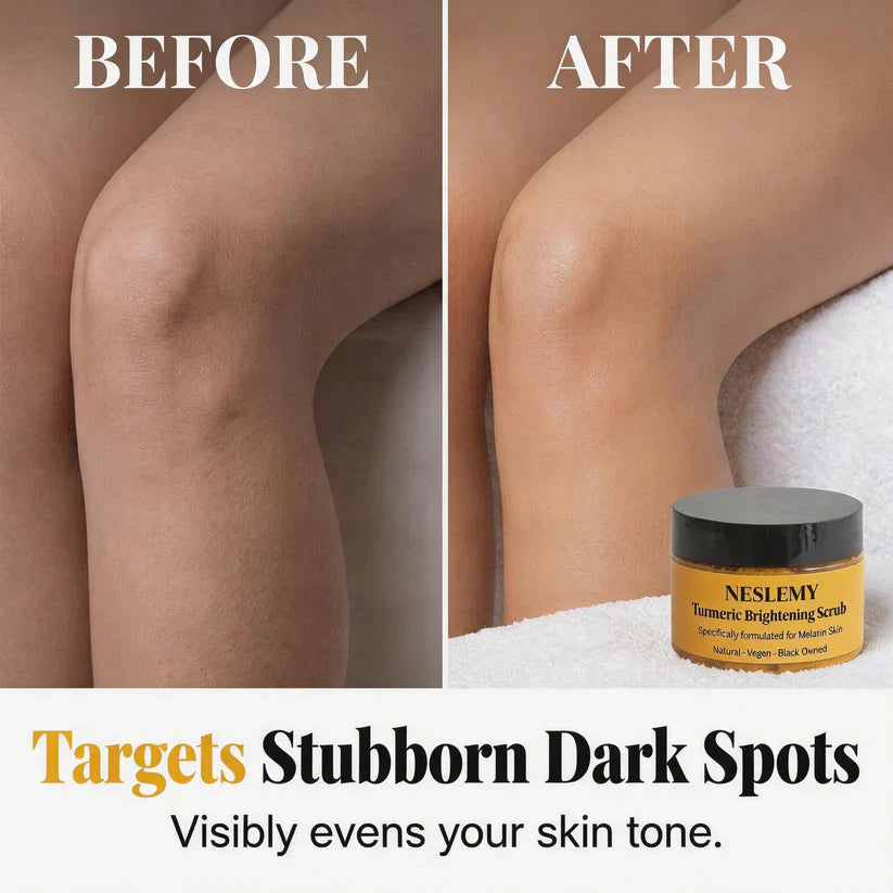 🏆July Xmas Deal: LIMITED-TIME 30% OFF!✨Turmeric Exfoliating Body Scrub