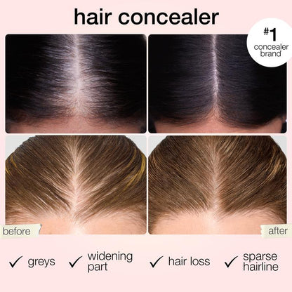 Last Day 49% OFF🔥 shape tape dab & go hair concealer