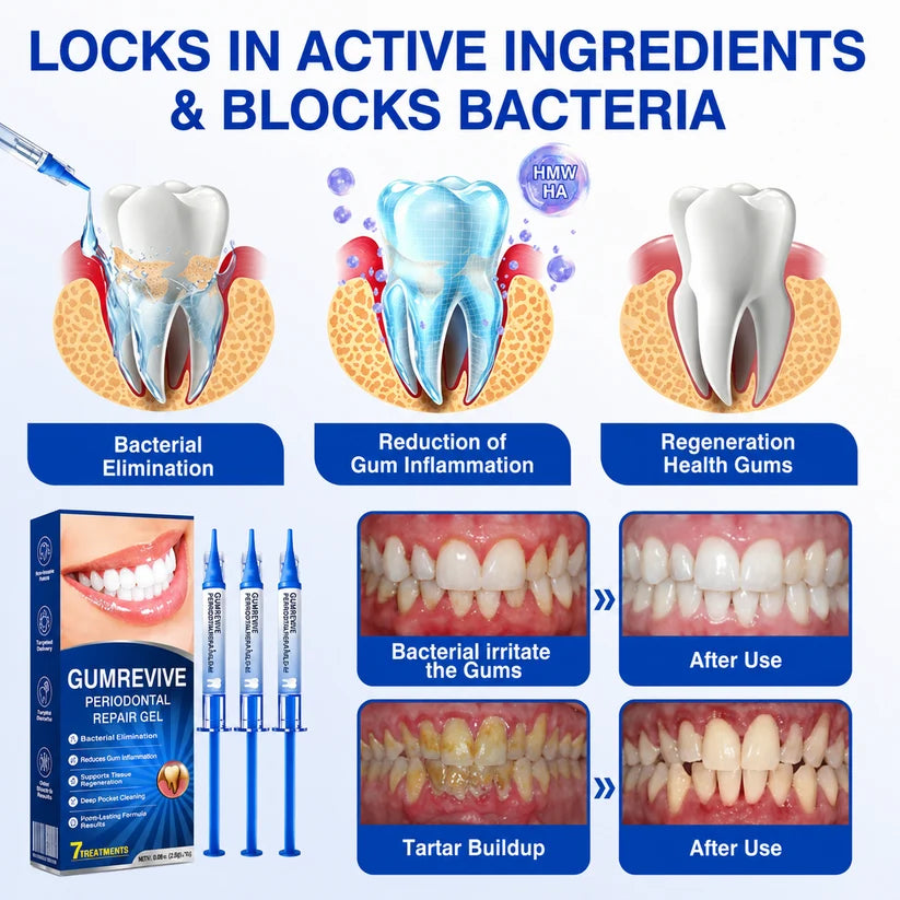 Periodontal Repair Gel