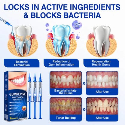 Periodontal Repair Gel