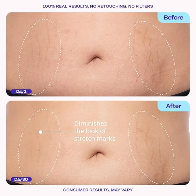 🔥LAST DAY 50% Body Firming Cream