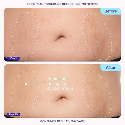🔥LAST DAY 50% Body Firming Cream